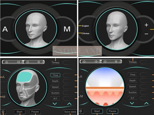 Halbleiter 808nm Laser Diode Laser Haarentfernung Maschine mit Hautkontakt Sensor Sicherstellung schneller Haarentfernung Behandlung