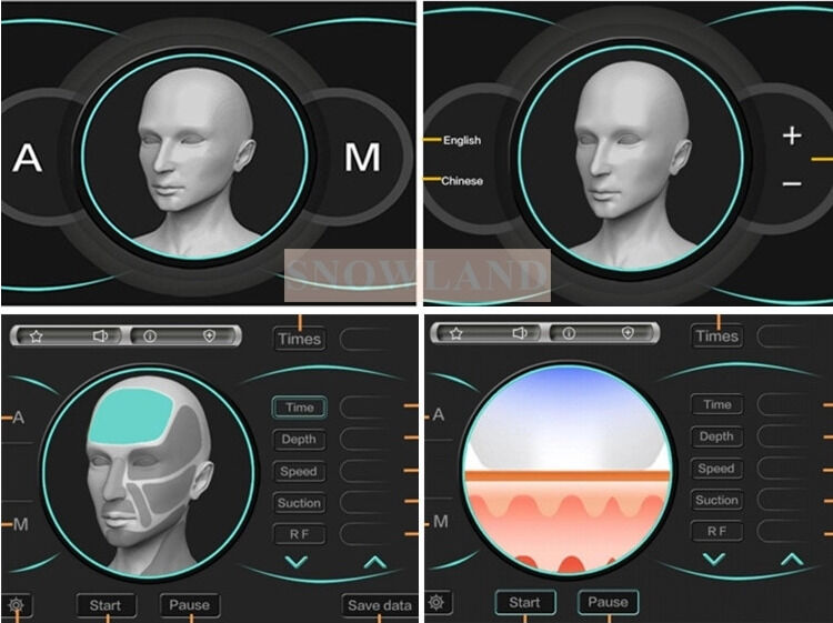 Halbleiter 808nm Laser Diode Laser Haarentfernung Maschine mit Hautkontakt Sensor Sicherstellung schneller Haarentfernung Behandlung